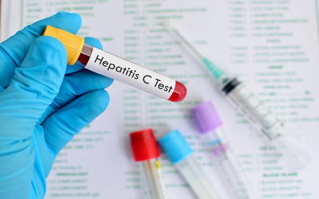 ہیپاٹائٹس کنٹرول پروگرام کی آڑ میں خزانےکو کروڑوں روپے کا نقصان