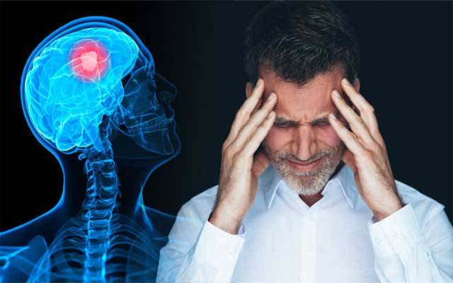 برین ٹیومر سے بچاؤ کیسے ممکن؟