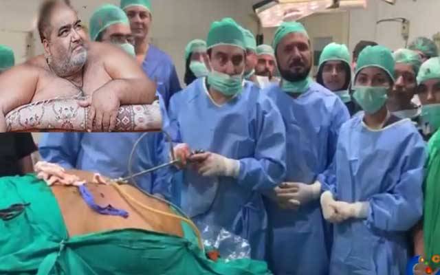 330 کلو وزنی نورالحسن کا آپریشن کامیاب ہو گیا