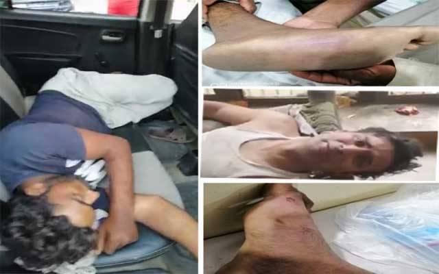 پولیس تشدد سے مرنے والے عامر کی پوسٹمارٹم رپورٹ میں ہولناک انکشافات