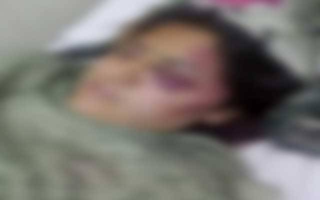 ایک اور حوا کی بیٹی سسرالیوں کے تشدد کا شکار