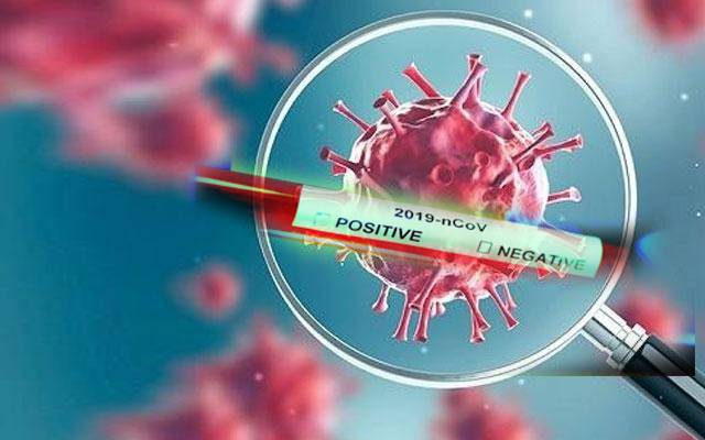 لاہور میں مزید 21 افراد میں   کورونا وائرس کی تصدیق 