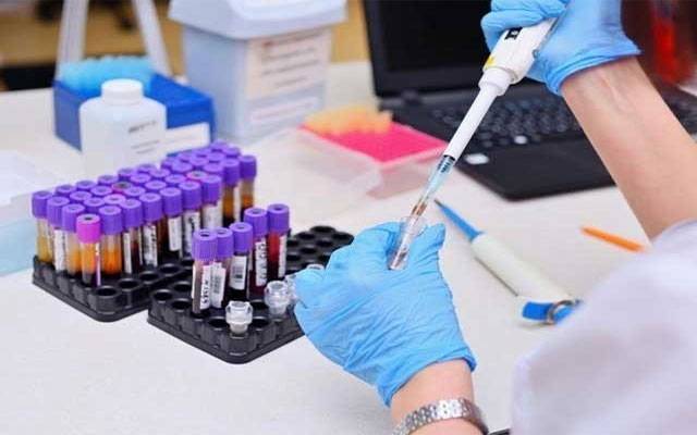  کورونا ٹیسٹنگ لیب کے عملے کیلئے اضافی تنخواہ کا اعلان