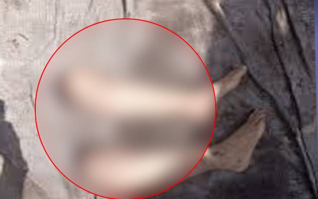 کوڑے دان سے خاتون کی کٹی ہوئی ٹانگیں برآمد 