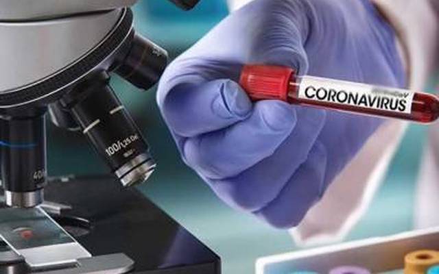 کورونا ٹیسٹ کیلئے20 ہزار تشخیصی کٹ ضائع ہونے کا خدشہ