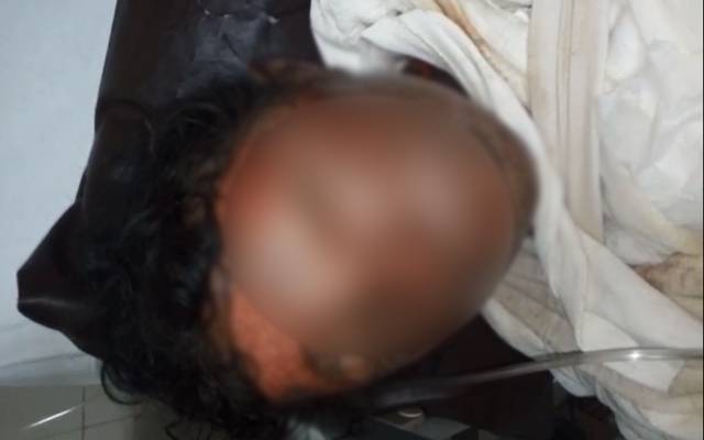 سفاکیت کی انتہا،سسرالیوں نےبہو کو آگ لگادی