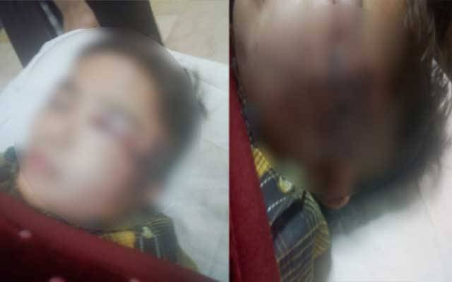 سپیشل سکیورٹی اہلکار کا بچے پر بہیمانہ تشدد