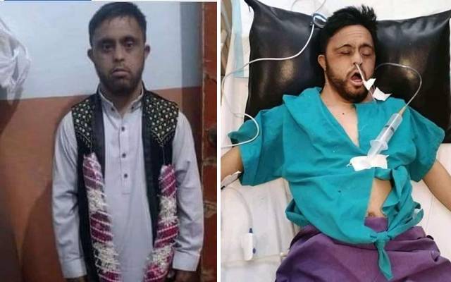 کیا واقعی عبید کے گردے نکال لئے گئے؟ سچ سامنے آگیا