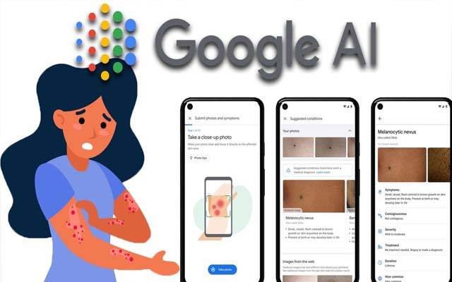 Google AI App For Detecting Skin condition