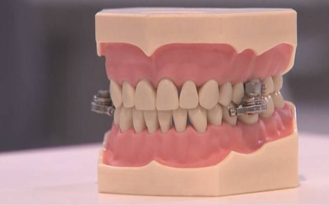 Teeth Technology