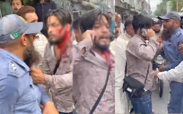 ٹریفک وارڈن کا شہری پر بدترین تشدد، سر پھاڑ دیا