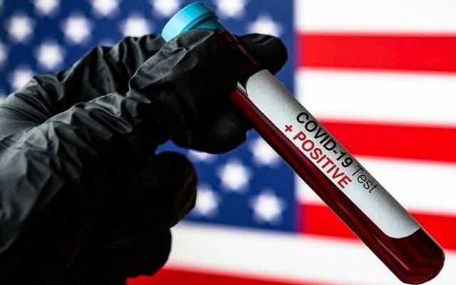 Corona virus kills 1,500 people a day in the United States