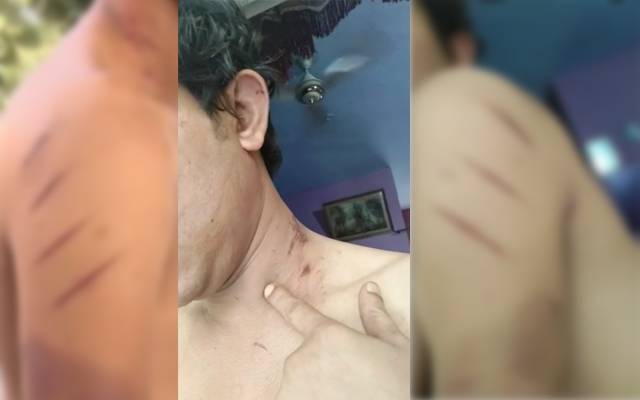 Wahdat Colony Torture by Drug dealers -