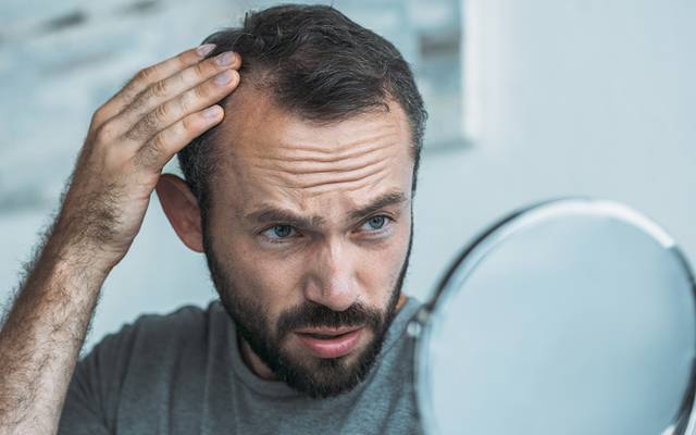 Hair fall increase in youth