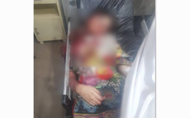 A 17-year-old girl committed suicide