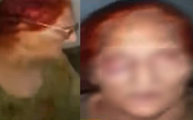 Old women Torture