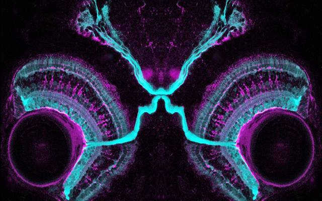 Zebra fish Brain