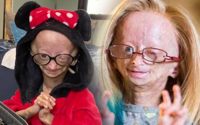 Adalia Rose