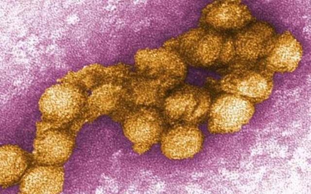 West Nile Virus