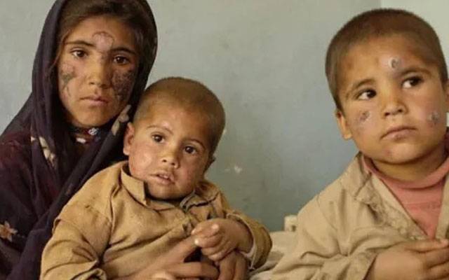 بلوچستان میں لیشمینیا وائرس کا پھیلاوتیز ، 22 اضلاع لپیٹ میں آگئے