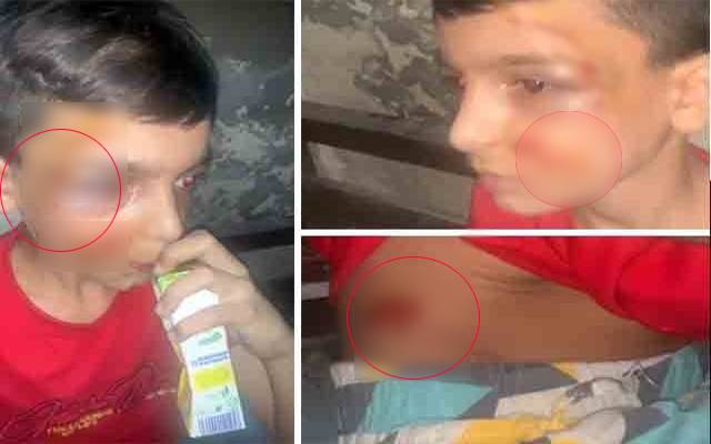 Tortured ,Child,Lahore