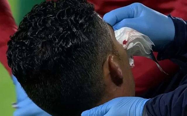Cristiano Ronaldo injured 
