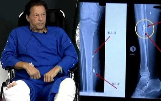Imran Khan medical report issued 