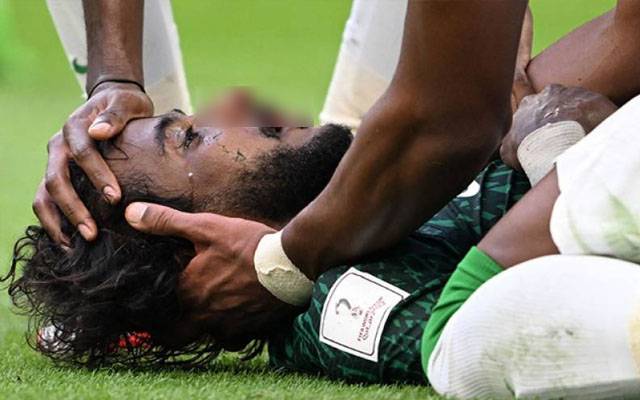 ارجنٹائن کے ساتھ میچ کے دوران سعودی کھلاڑی کا جبڑا ٹوٹ گیا