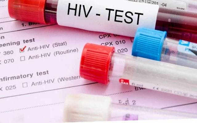 ملک میں ایچ آئی وی کا پھیلاؤ تشویشناک حد تک بڑھ گیا