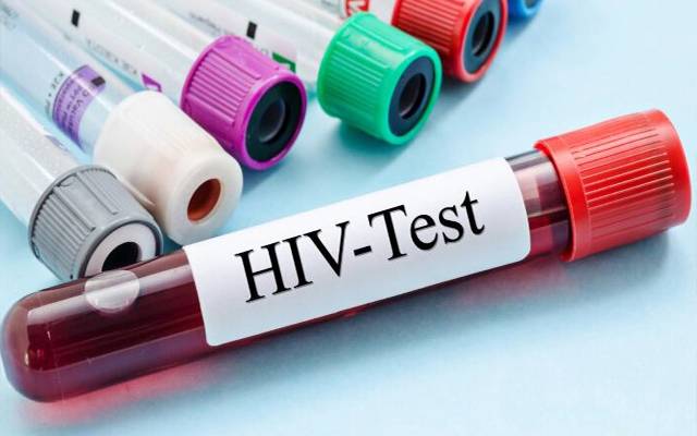 دنیا بھر میں ایچ آئی وی سے آگاہی کا دن آج منایا جارہا ہے