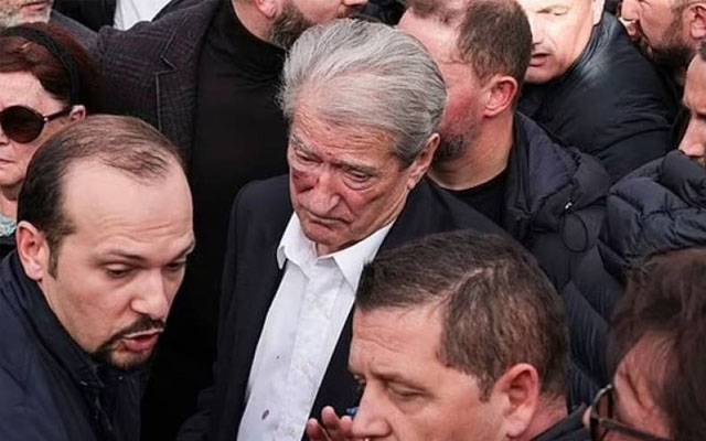 البانیہ کے سابق وزیراعظم کو مکا پڑگیا، خون نکل آیا