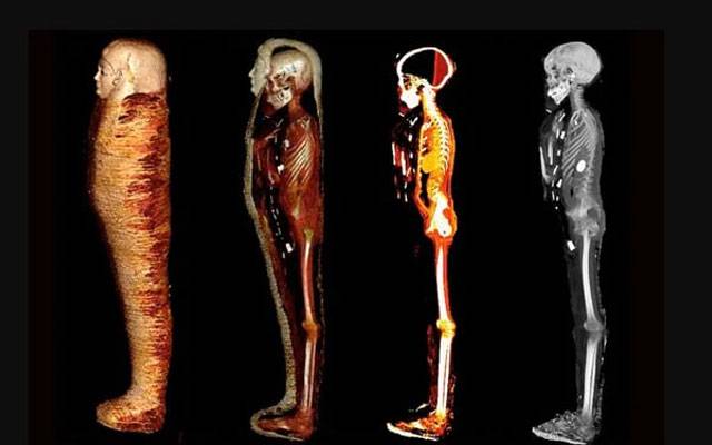 Gold 'second heart' discovered in Egyptian boy's mummy