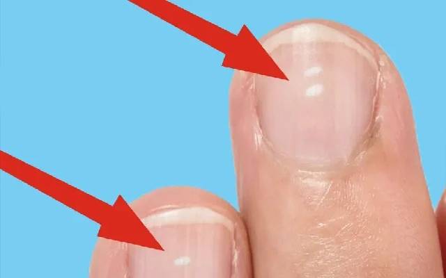 ناخنوں کی رنگت سے آپ کی صحت کا اندازہ کیسے لگایا جاسکتا ہے؟