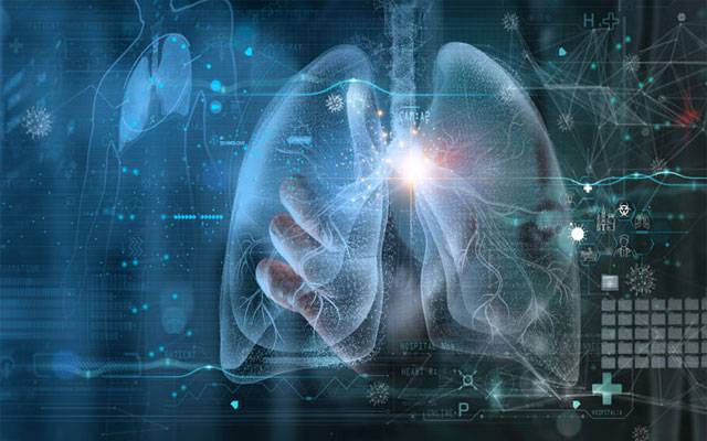 Artificial Intelligence, AI, London, Lungs Cancer, Tumor, Scince, Technology, CT Scan, Lung Cancer Screening, Treatment, City42