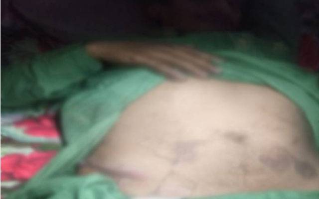  ظالموں نے ذہنی معذور لڑکا بھی نہ چھوڑا،  اغوا کے بعد گردہ نکالنے کا انکشاف   