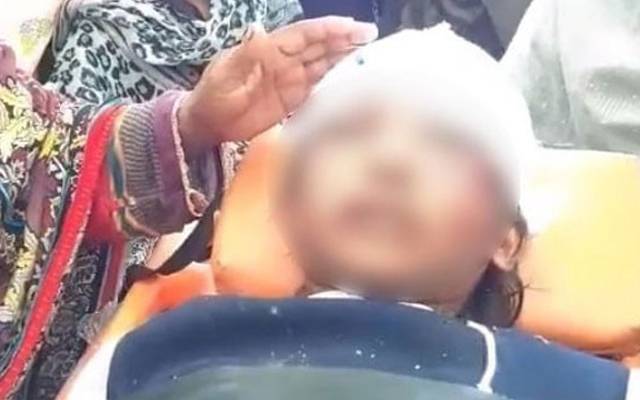 بدترین تشدد کا نشانہ بننے والی گھریلو ملازمہ رضوانہ کی آکسیجن ہٹادی گئی