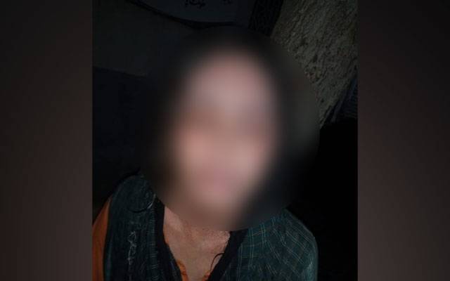  گھریلو جھگڑے پر خاوند نے بیوی کے منہ پر تیزاب پھینک دیا