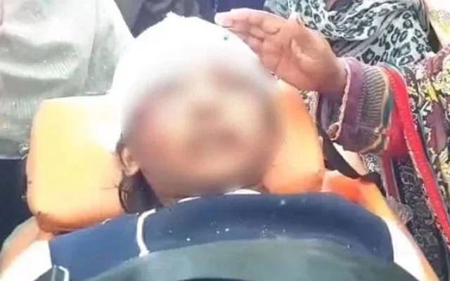 رضوانہ میں انفیکشن تاحال موجود، سر پر گہرے اور بڑے زخم ہیں, میڈیکل بورڈ 