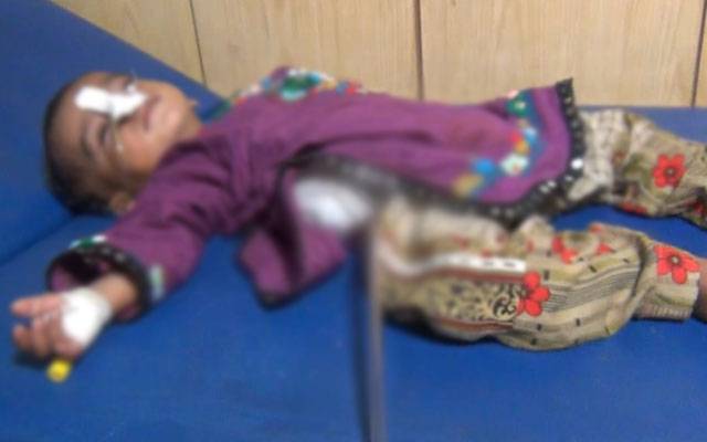  10ماہ کی بچی کے آپریشن کے دوران پیٹ سے بچہ نکل آیا