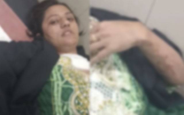 جائیداد کی تقسیم کا معاملہ، سوتیلے چچا اور رشتہ داروں نے خاتون وکیل پر تیزاب پھینک دیا