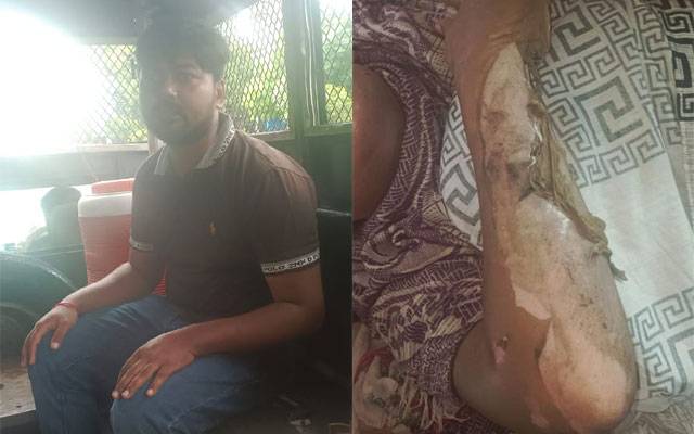 Lahore Crimes against women, City42, Woman burnt alive