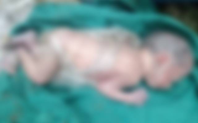 جنرل ہسپتال، گیٹ نمبر 2 کے قریب نومولود کی لاش برآمد