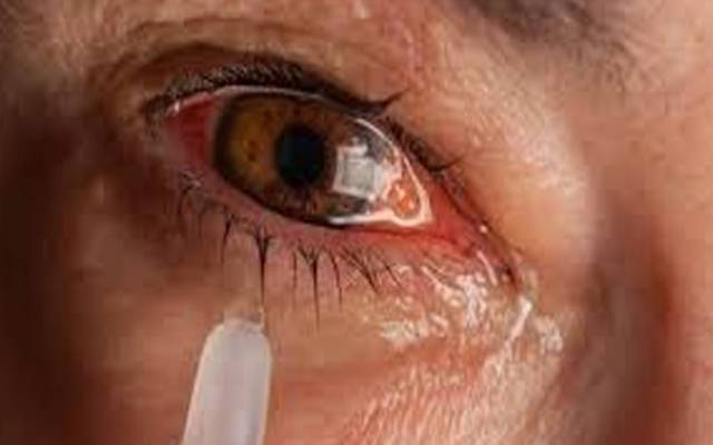 آشوب چشم ,نئی مشکل کھڑی ہو گئی، آئی ڈراپس مارکیٹ سے غائب 