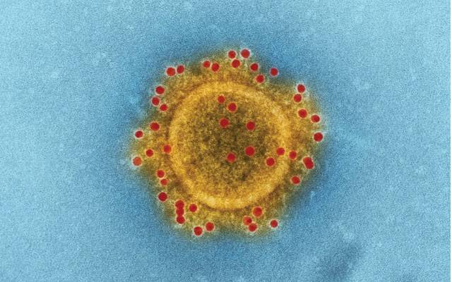 Nipah virus, Global Center for Health Security, University of Nebraska Medical Center, City42