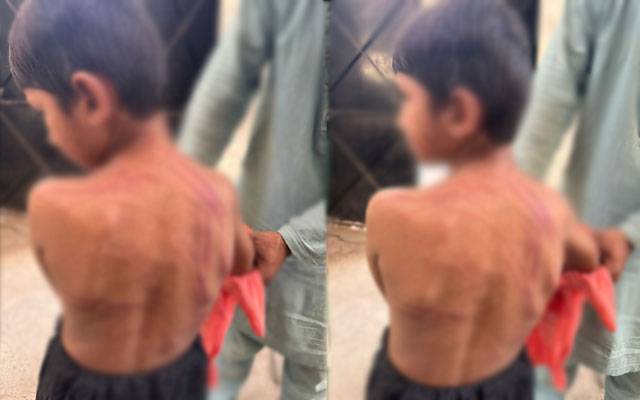  مدرسہ کے قاری کا 8 سالہ طالب علم پر بہیمانہ تشدد