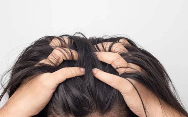  سر میں مسلسل خارش  کے شکار افراد سے متعلق  ماہرین کا اہم انکشاف 