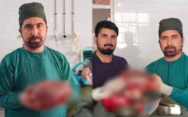 شمالی وزیرستان؛ کامیاب آپریشن، خاتون کے رحم سے 10 کلو وزنی دو رسولیاں نکال لیں گئیں
