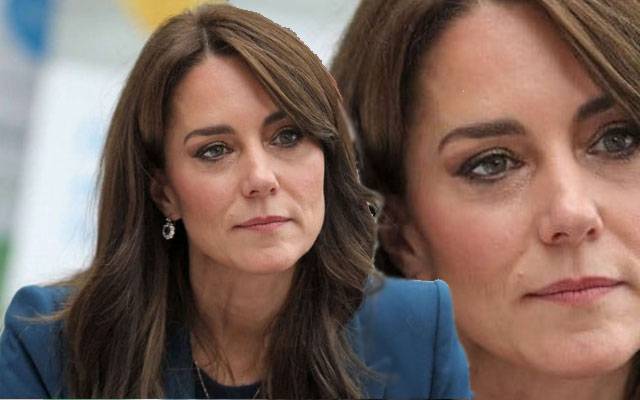 Princess Kate, Censer diagnoses, Chemo Therapy, City42 