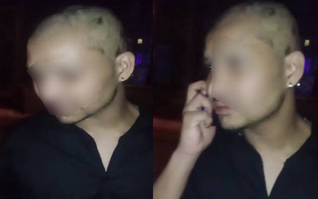  ڈیفنس :ملازم پر چوری کا الزام لگاتے ہوئے اس کا سر منڈوا دیا