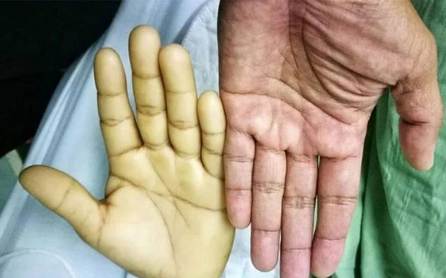 خون کی کمی دور کرنے کے لیے بہترین غذائیں